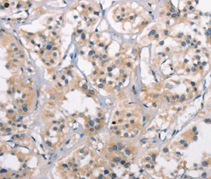 Immunohistochemistry (Formalin/PFA-fixed paraffin-embedded sections) - Anti-CTAG1B antibody (AB198878)