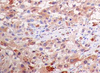 Immunohistochemistry (Formalin/PFA-fixed paraffin-embedded sections) - Anti-CTAG1B antibody [EPR13780] (AB183740)