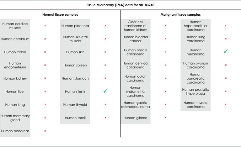 Immunohistochemistry (Formalin/PFA-fixed paraffin-embedded sections) - Anti-CTAG1B antibody [EPR13780] - BSA and Azide free (AB225536)