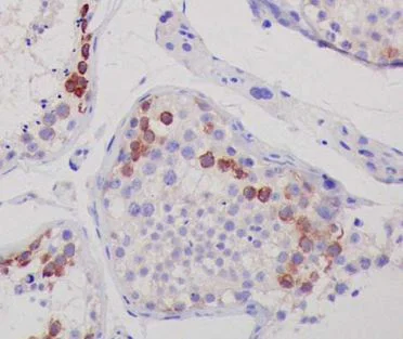 Immunohistochemistry (Formalin/PFA-fixed paraffin-embedded sections) - Anti-CTAG1B antibody [EPR13780] - BSA and Azide free (AB225536)