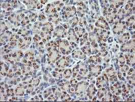 Immunohistochemistry (Formalin/PFA-fixed paraffin-embedded sections) - Anti-CTAG1B antibody [OTI4D8] (AB139339)