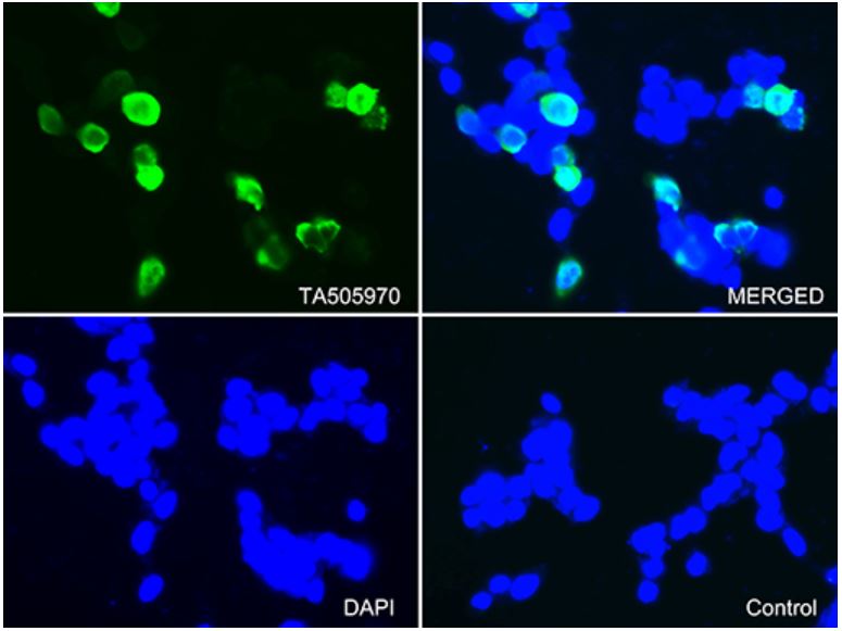 Immunocytochemistry - Anti-CTAG1B antibody [OTI4D8] - BSA and Azide free (AB275373), expandable thumbnail