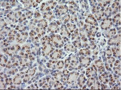 Immunohistochemistry (Formalin/PFA-fixed paraffin-embedded sections) - Anti-CTAG1B antibody [OTI4D8] - BSA and Azide free (AB275373), expandable thumbnail