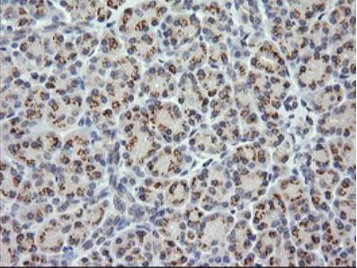 Immunohistochemistry (Formalin/PFA-fixed paraffin-embedded sections) - Anti-CTAG1B antibody [OTI4D8] - BSA and Azide free (AB275373)