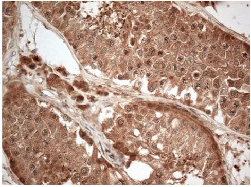 Immunohistochemistry (Formalin/PFA-fixed paraffin-embedded sections) - Anti-CTAG1B antibody [OTI4D8] - BSA and Azide free (AB275373)