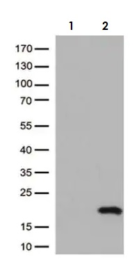 Western blot - Anti-CTAG1B antibody [OTI4D8] - BSA and Azide free (ab275373), expandable thumbnail