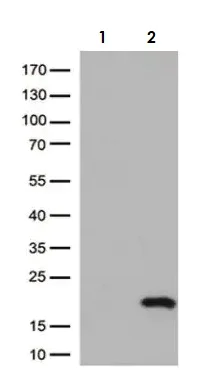 Western blot - Anti-CTAG1B antibody [OTI4D8] - BSA and Azide free (AB275373)