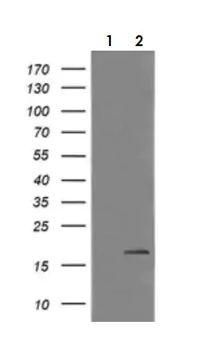 Western blot - Anti-CTAG1B antibody [OTI4D8] - BSA and Azide free (AB275373)