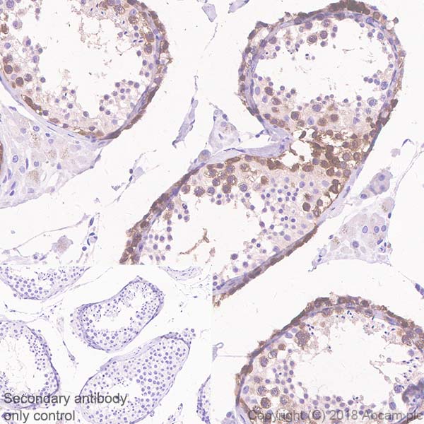 Immunohistochemistry (Formalin/PFA-fixed paraffin-embedded sections) - Anti-CTAG1B antibody [SP349] - BSA and Azide free (AB242416), expandable thumbnail