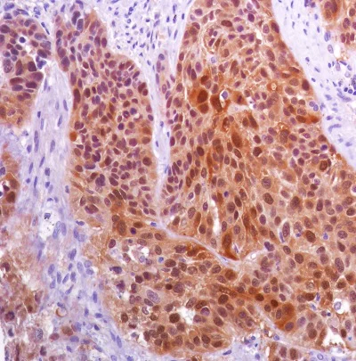 Immunohistochemistry (Formalin/PFA-fixed paraffin-embedded sections) - Anti-CTAG1B antibody [SP349] - BSA and Azide free (AB242416)