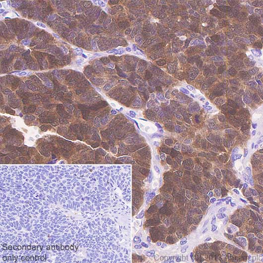 Immunohistochemistry (Formalin/PFA-fixed paraffin-embedded sections) - Anti-CTAG1B antibody [SP349] - BSA and Azide free (AB242416), expandable thumbnail