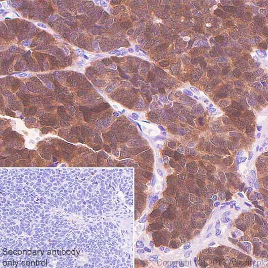 Immunohistochemistry (Formalin/PFA-fixed paraffin-embedded sections) - Anti-CTAG1B antibody [SP349] - BSA and Azide free (AB242416)