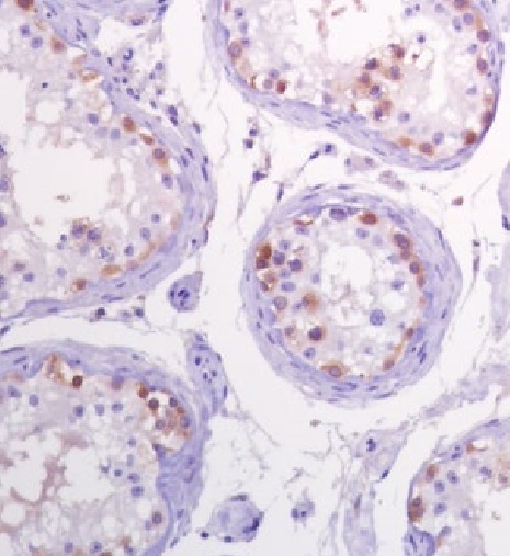 Immunohistochemistry (Formalin/PFA-fixed paraffin-embedded sections) - Anti-CTAG1B antibody [SP349] - BSA and Azide free (AB242416), expandable thumbnail
