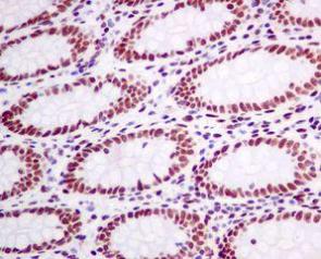 Immunohistochemistry (Formalin/PFA-fixed paraffin-embedded sections) - Anti-CtBP1 antibody [EPR6800] - BSA and Azide free (AB248335), expandable thumbnail