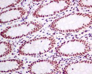 Immunohistochemistry (Formalin/PFA-fixed paraffin-embedded sections) - Anti-CtBP1 antibody [EPR6800] - BSA and Azide free (AB248335)
