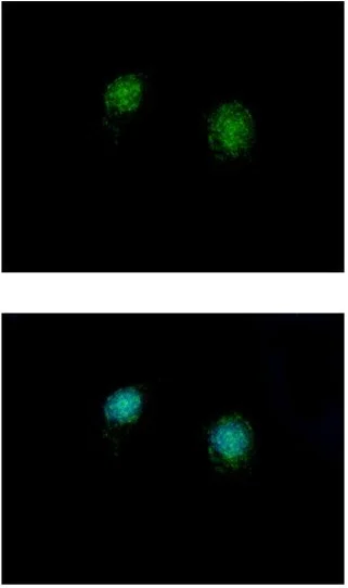 Immunocytochemistry/ Immunofluorescence - Anti-CTBP2 antibody (AB151766)