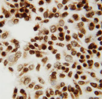 Immunocytochemistry - Anti-CTBP2 antibody - C-terminal (AB190933)