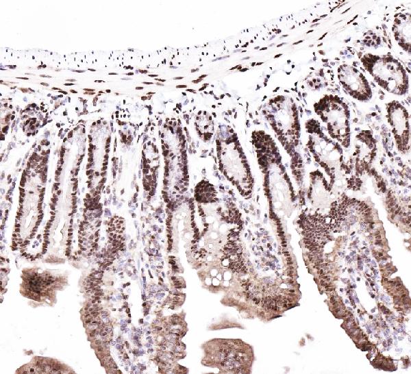 Immunohistochemistry (Formalin/PFA-fixed paraffin-embedded sections) - Anti-CTBP2 antibody - C-terminal (AB190933), expandable thumbnail