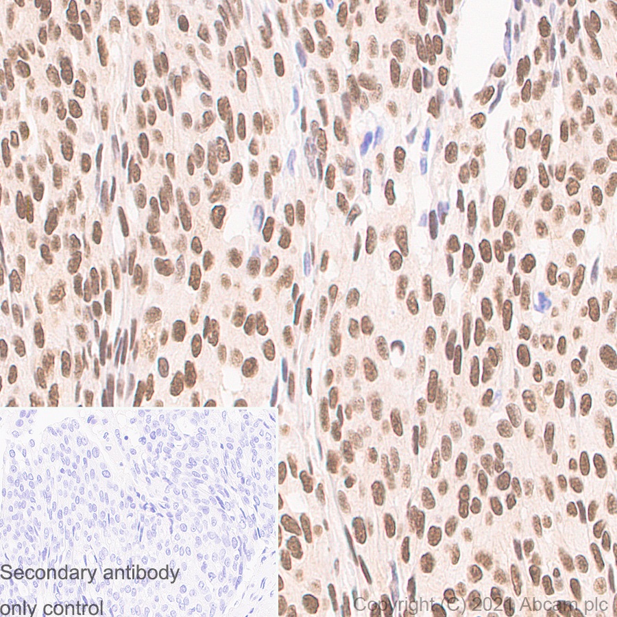 Immunohistochemistry (Formalin/PFA-fixed paraffin-embedded sections) - Anti-CTBP2 antibody [EPR7611(B)] (AB128871), expandable thumbnail