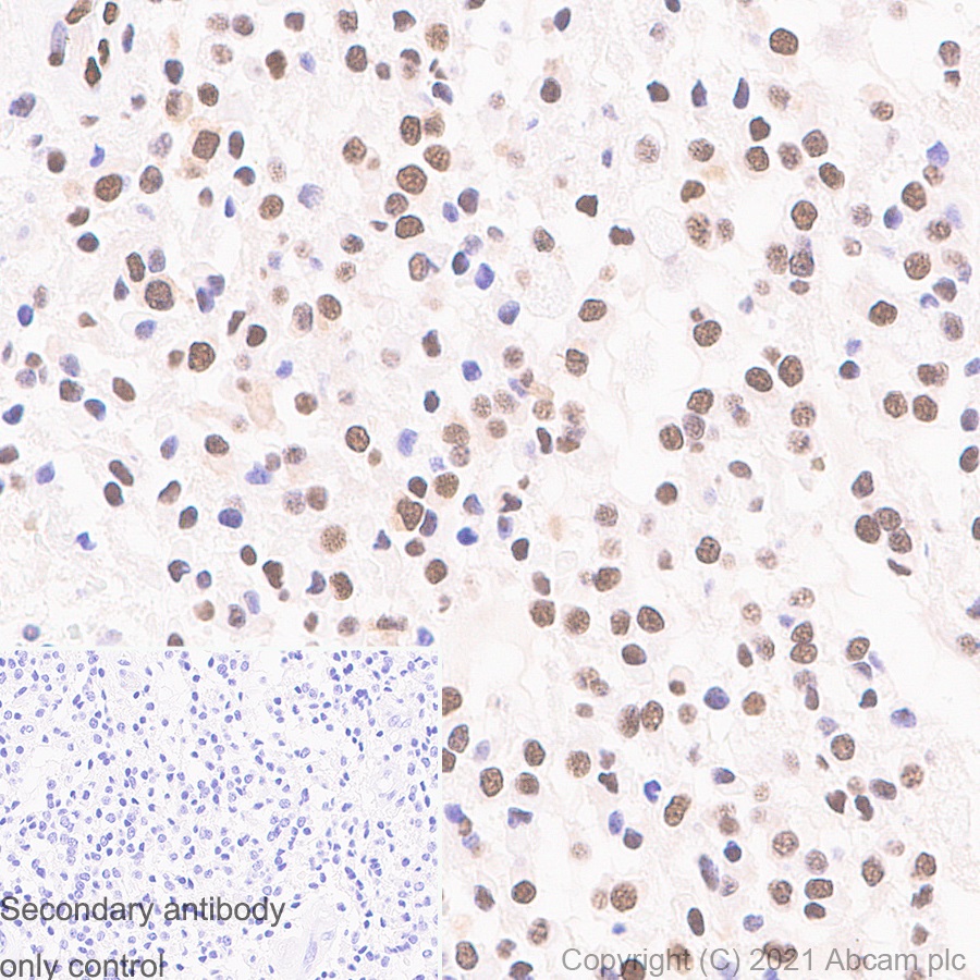 Immunohistochemistry (Formalin/PFA-fixed paraffin-embedded sections) - Anti-CTBP2 antibody [EPR7611(B)] (ab128871), expandable thumbnail