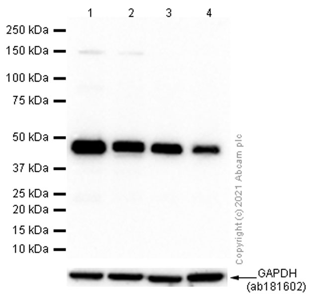 Western blot - Anti-CTBP2 antibody [EPR7611(B)] (AB128871), expandable thumbnail