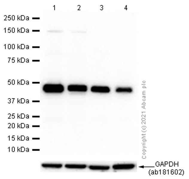 Western blot - Anti-CTBP2 antibody [EPR7611(B)] (AB128871)
