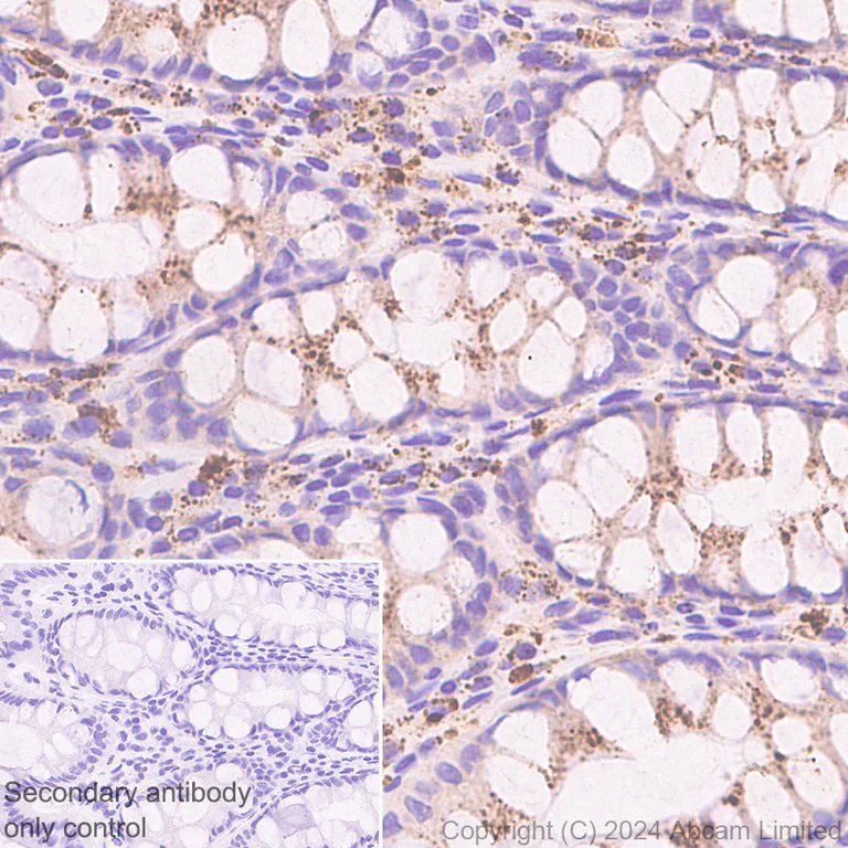 Immunohistochemistry (Formalin/PFA-fixed paraffin-embedded sections) - Anti-CTBS antibody [EPR29368-588] - BSA and Azide free (AB322066)
