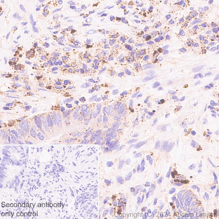 Immunohistochemistry (Formalin/PFA-fixed paraffin-embedded sections) - Anti-CTBS antibody [EPR29368-588] - BSA and Azide free (AB322066)