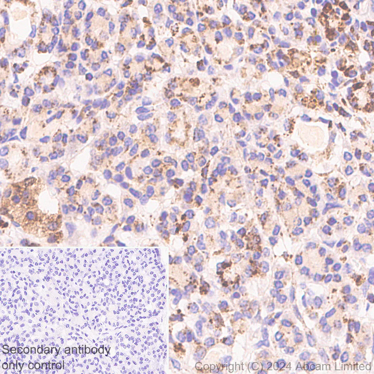 Immunohistochemistry (Formalin/PFA-fixed paraffin-embedded sections) - Anti-CTBS antibody [EPR29368-588] - BSA and Azide free (AB322066)