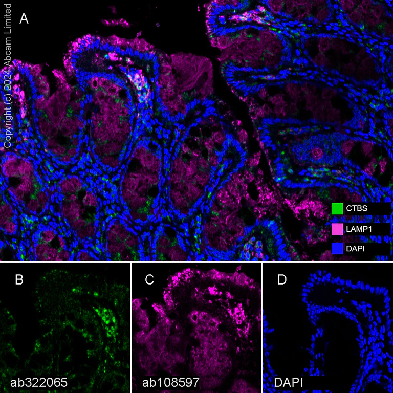 Multiplex immunohistochemistry - Anti-CTBS antibody [EPR29368-588] - BSA and Azide free (AB322066)