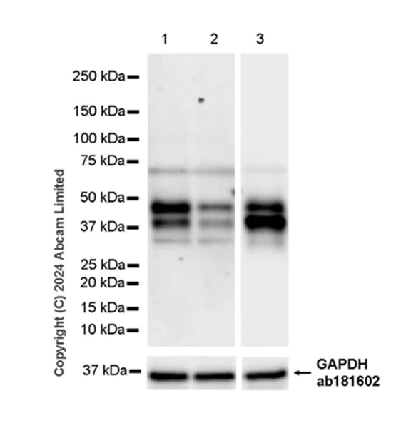 Western blot - Anti-CTBS antibody [EPR29368-588] - BSA and Azide free (AB322066)