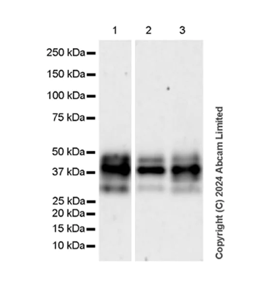 Western blot - Anti-CTBS antibody [EPR29368-588] - BSA and Azide free (AB322066)