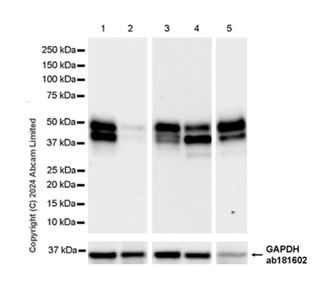 Western blot - Anti-CTBS antibody [EPR29368-588] - BSA and Azide free (AB322066)