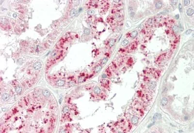 Immunohistochemistry (Formalin/PFA-fixed paraffin-embedded sections) - Anti-CTC1 antibody (AB230538)