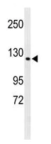 Western blot - Anti-CTC1 antibody (AB230538)