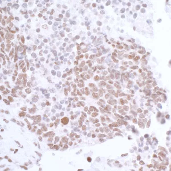 Immunohistochemistry (Formalin/PFA-fixed paraffin-embedded sections) - Anti-CTCF antibody (AB70303)