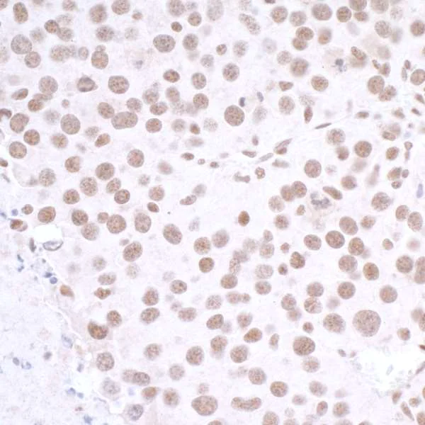 Immunohistochemistry (Formalin/PFA-fixed paraffin-embedded sections) - Anti-CTCF antibody (AB70303)