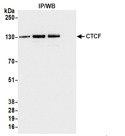 Immunoprecipitation - Anti-CTCF antibody (AB70303)