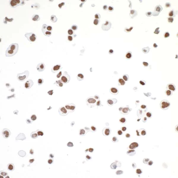 Immunocytochemistry - Anti-CTCF antibody [BLR041F] (AB243897)