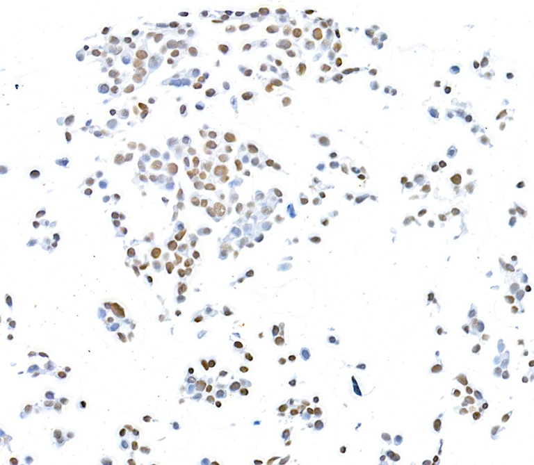 Immunocytochemistry - Anti-CTCF antibody [BLR041F] (AB243897)