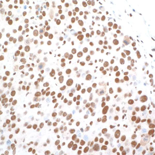 Immunohistochemistry (Formalin/PFA-fixed paraffin-embedded sections) - Anti-CTCF antibody [BLR041F] (AB243897)