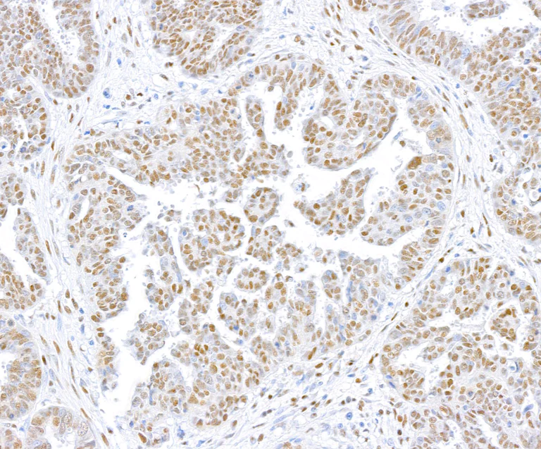 Immunohistochemistry (Formalin/PFA-fixed paraffin-embedded sections) - Anti-CTCF antibody [BLR041F] (AB243897)