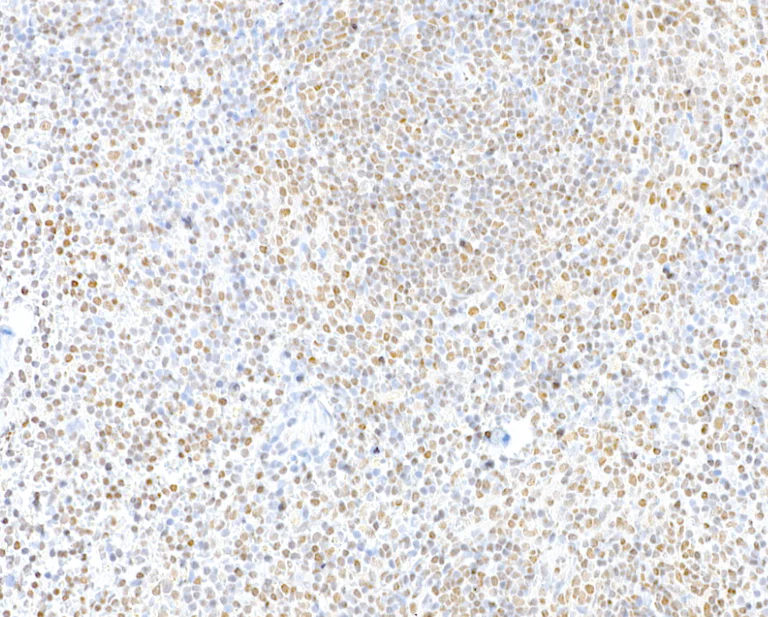 Immunohistochemistry (Formalin/PFA-fixed paraffin-embedded sections) - Anti-CTCF antibody [BLR041F] (AB243897)