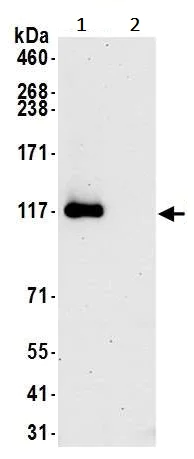 Immunoprecipitation - Anti-CTCF antibody [BLR041F] (AB243897)