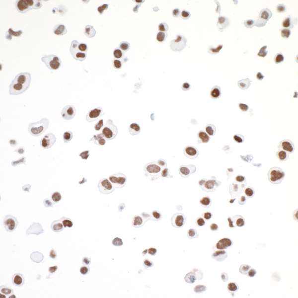 Immunocytochemistry - Anti-CTCF antibody [BLR041F] - BSA free (AB272091)