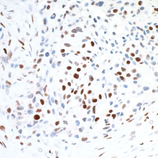 Immunohistochemistry (Formalin/PFA-fixed paraffin-embedded sections) - Anti-CTCF antibody [BLR041F] - BSA free (AB272091)