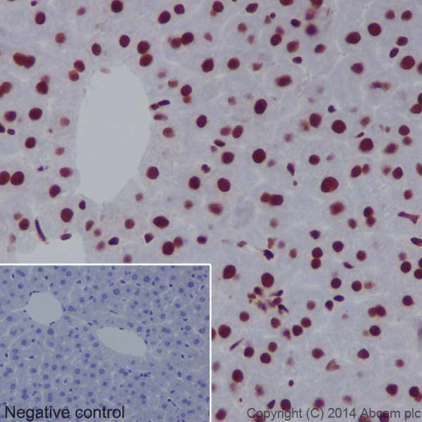 Immunohistochemistry (Formalin/PFA-fixed paraffin-embedded sections) - Anti-CTCF antibody [EPR18253] - ChIP Grade (ab188408), expandable thumbnail
