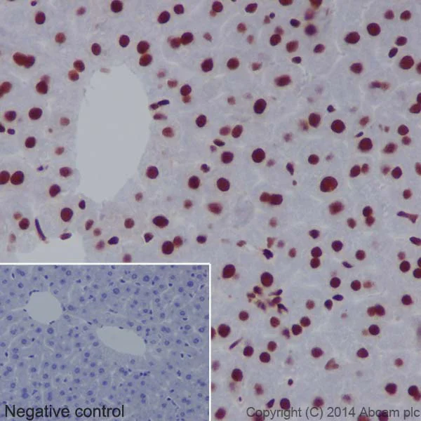 Immunohistochemistry (Formalin/PFA-fixed paraffin-embedded sections) - Anti-CTCF antibody [EPR18253] - ChIP Grade (AB188408)
