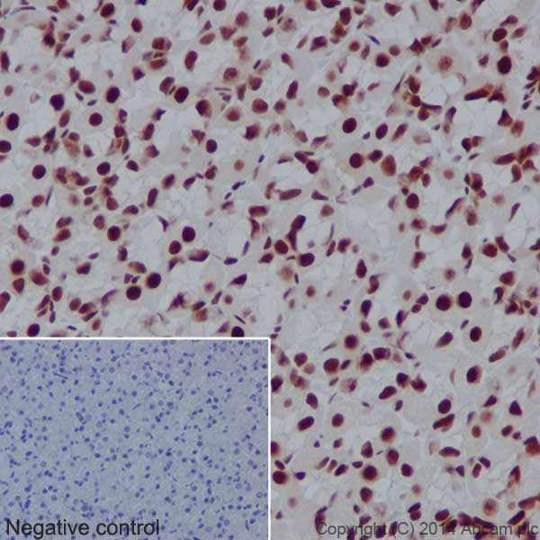 Immunohistochemistry (Formalin/PFA-fixed paraffin-embedded sections) - Anti-CTCF antibody [EPR18253] - ChIP Grade (ab188408), expandable thumbnail