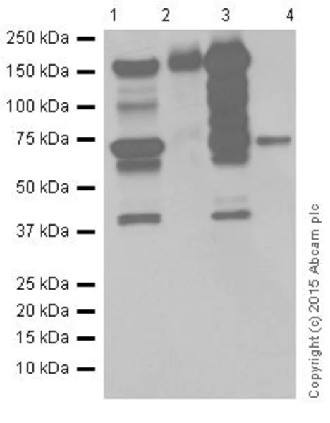 Western blot - Anti-CTCF antibody [EPR18253] - ChIP Grade (AB188408)